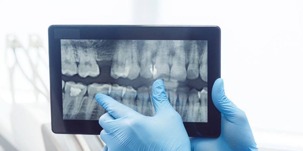 myDentalTX.com-9-Benefits-of-Digital-Dental-X-Rays